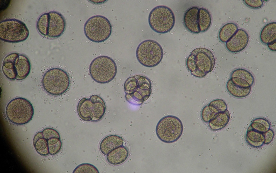 Учёные создали инъекционный «мини-печёночный орган» для временной поддержки печени